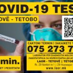 Тестирање за Ковид 19 - резултати за 30 мин